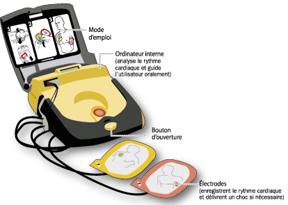 http://www.france-maison-de-retraite.org/blog-maisons-de-retraite/wp-content/uploads/2010/03/defibrillateur.png